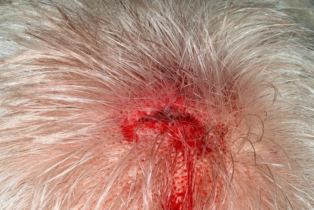 Cut scalp
