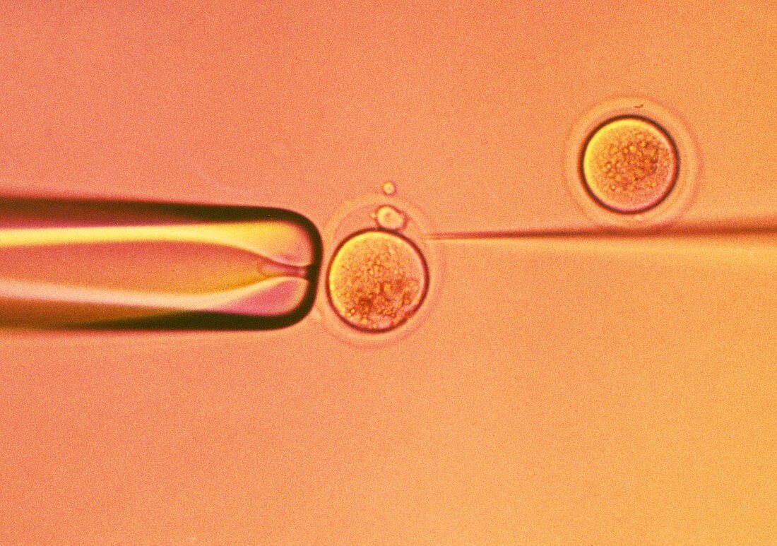 In vitro fertilisation