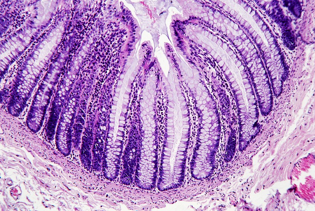 Large intestine lining,light micrograph