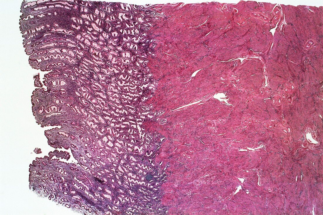 Uterus lining,light micrograph