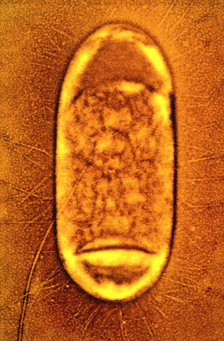 Salmonella typhimurium bacterium,TEM