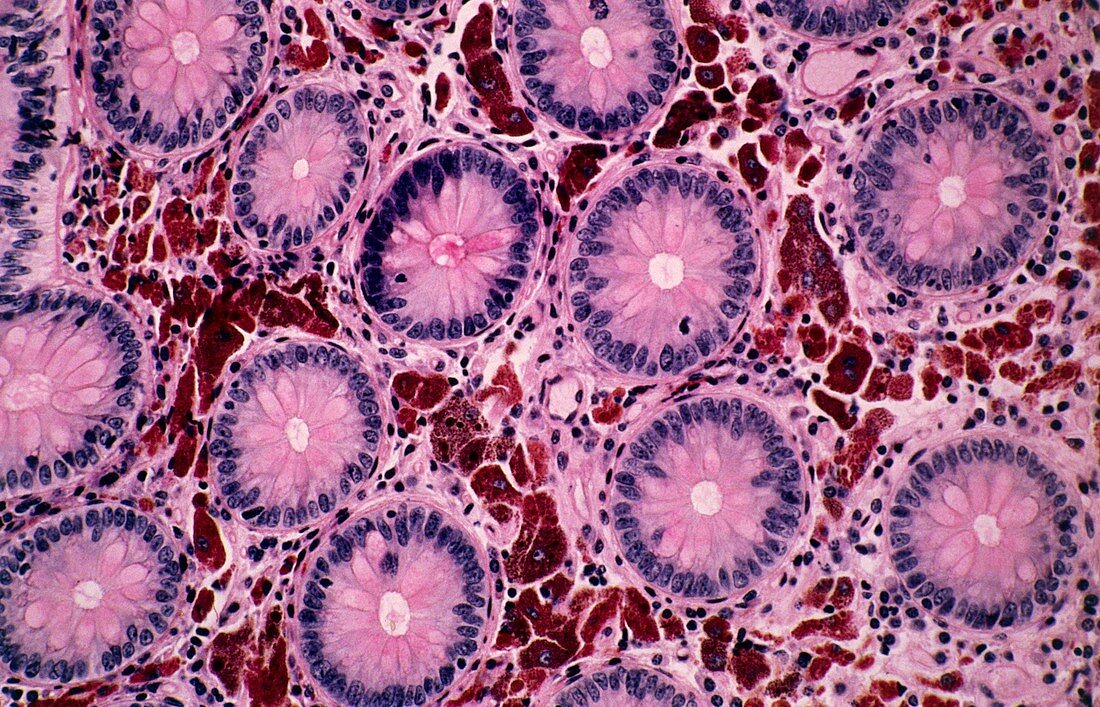 Melanosis coli,light micrograph