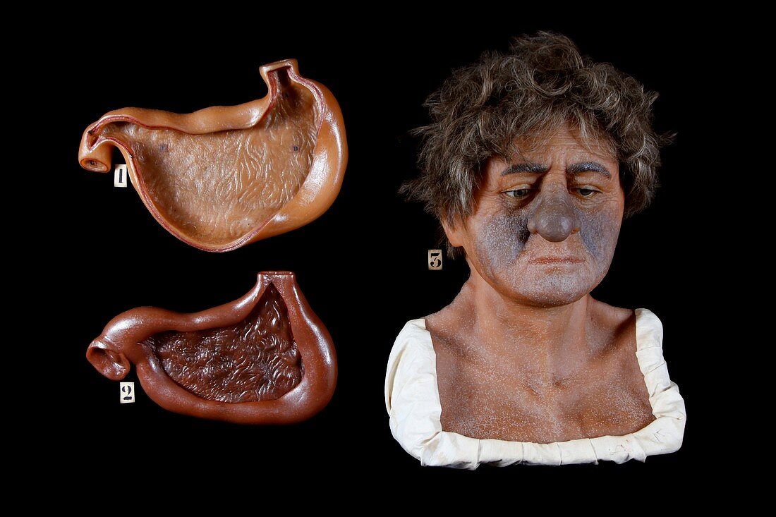 Wax model of the effects of alcohol