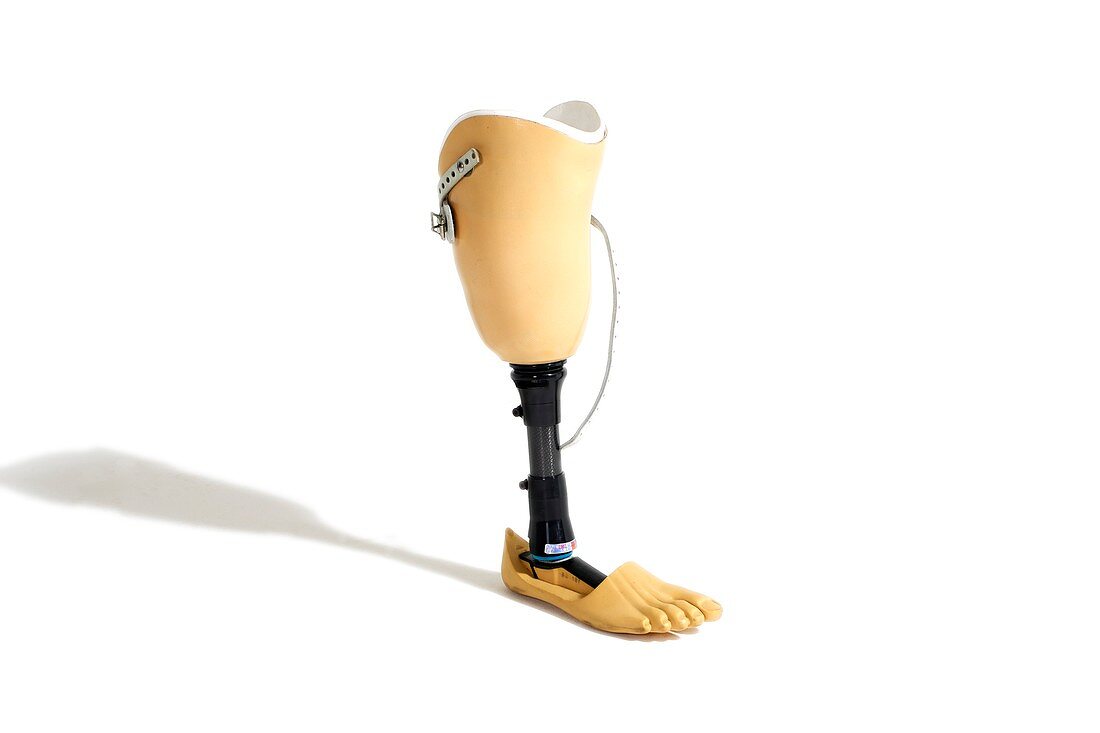 A prosthetic leg