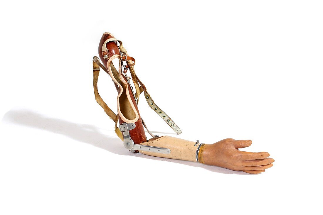 A prosthetic arm