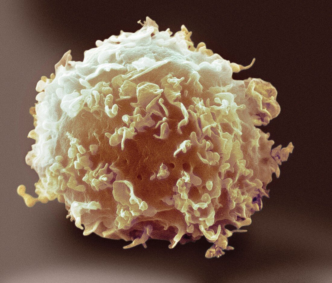 Monocyte white blood cell,SEM