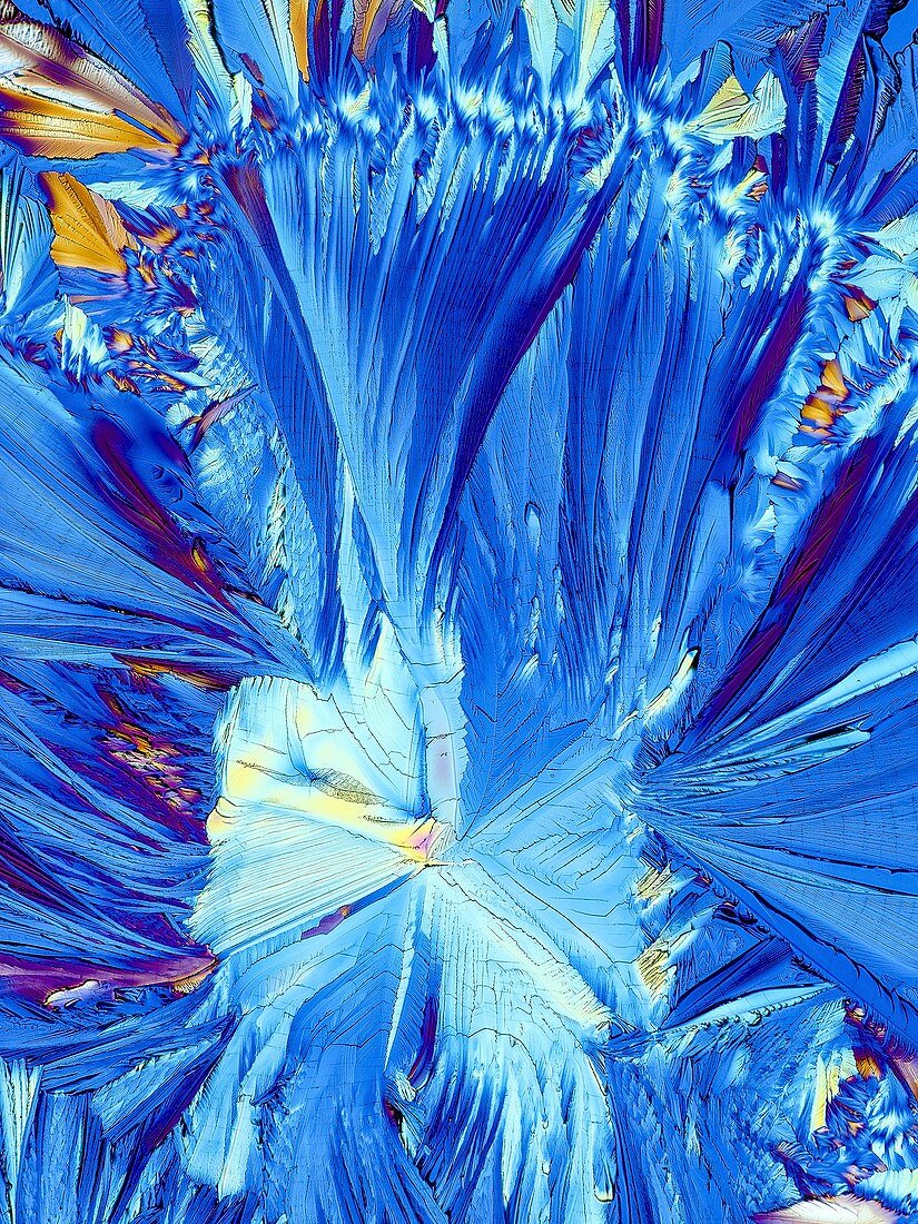 Cortisol crystals,light micrograph