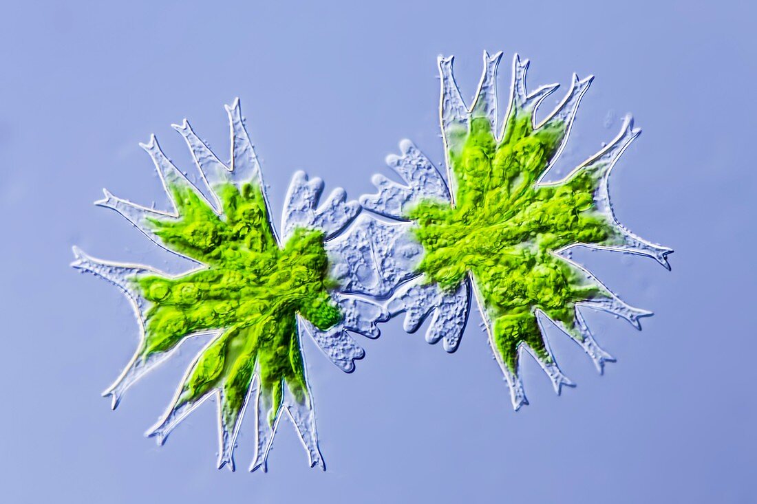 Micrasterias furcata green alga,LM