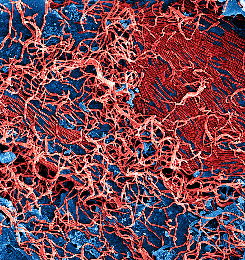 Ebola virus budding from cell,SEM