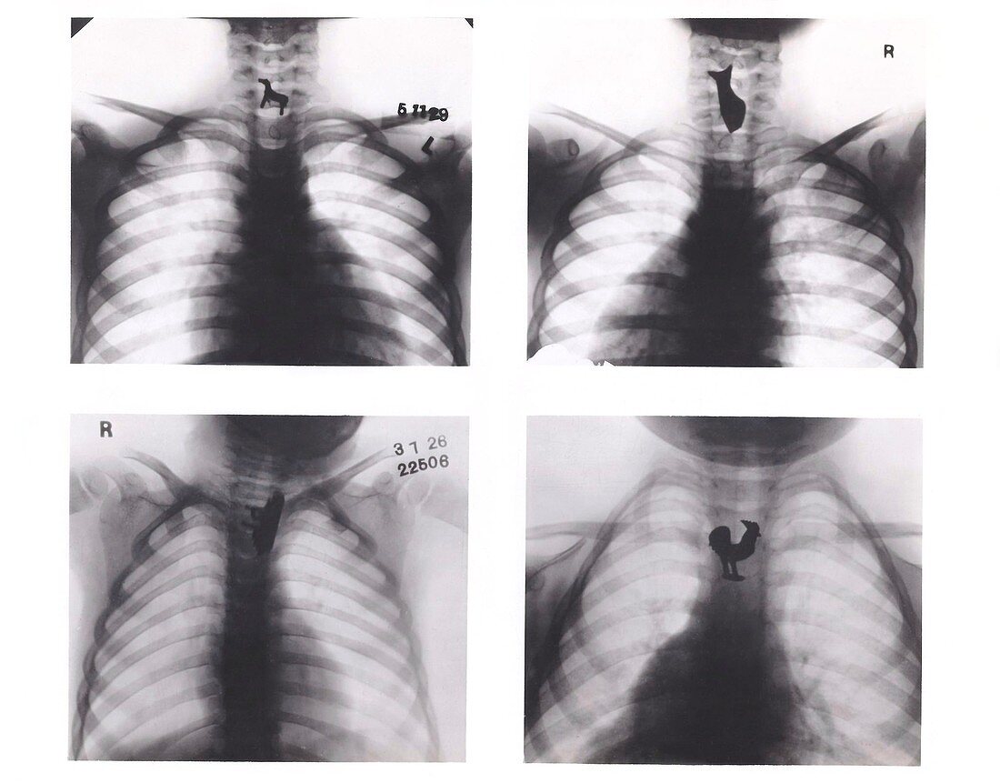 Swallowed trinkets,X-rays