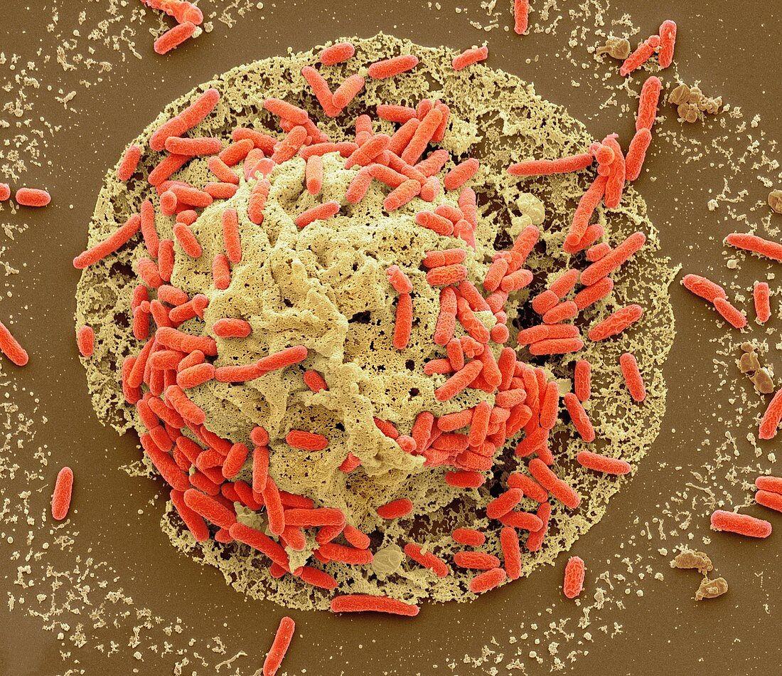 E. coli induced cell death,SEM