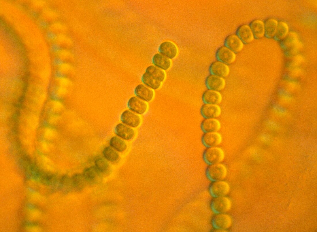 Anabaena sp.,light micrograph