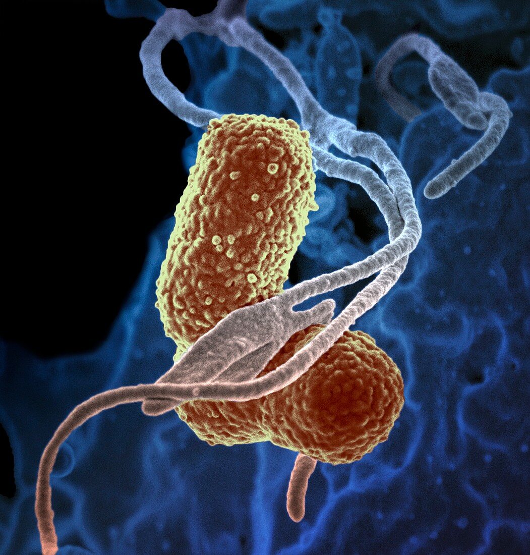 Klebsiella pneumoniae bacteria,SEM