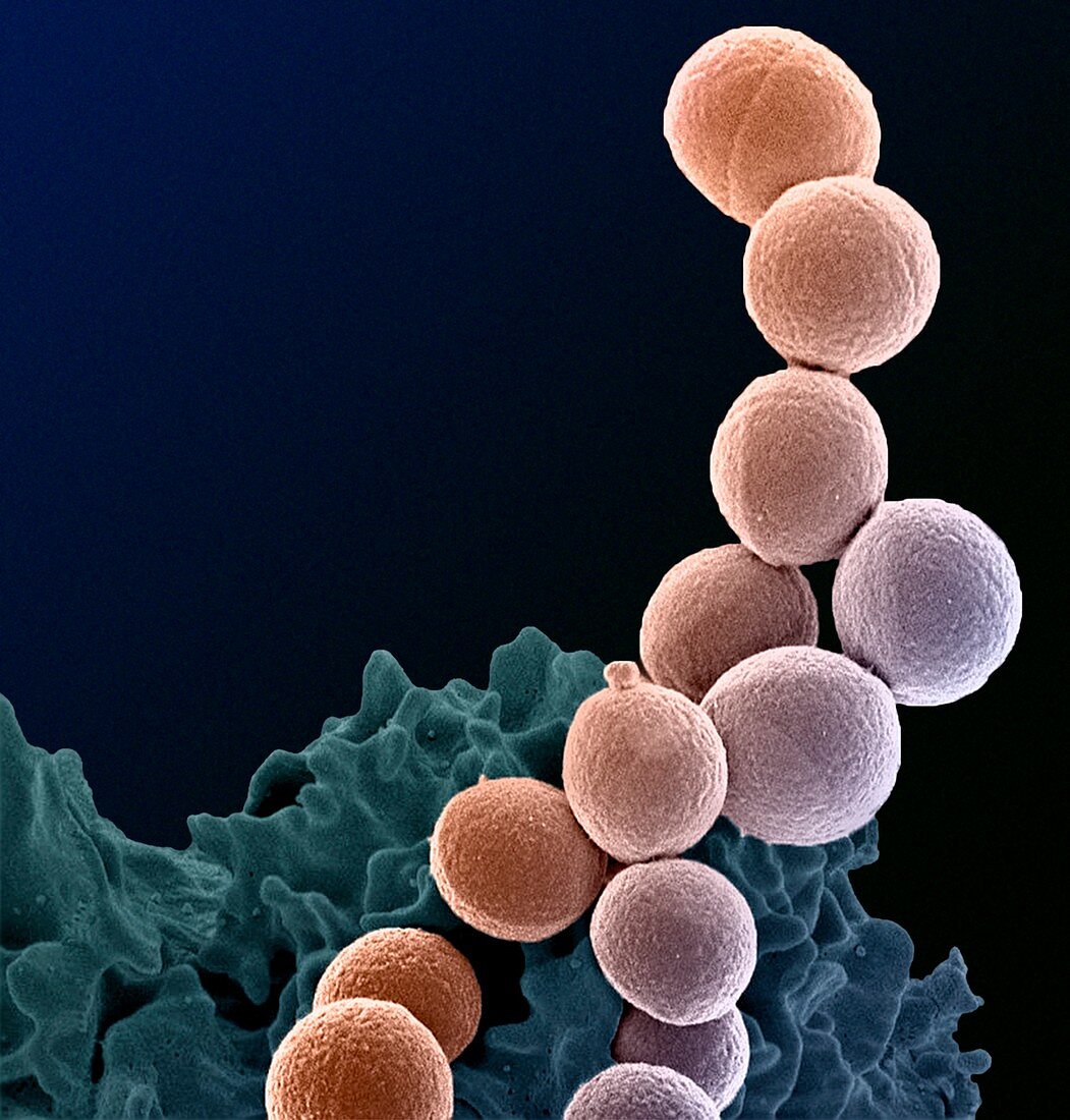 MRSA bacteria,SEM