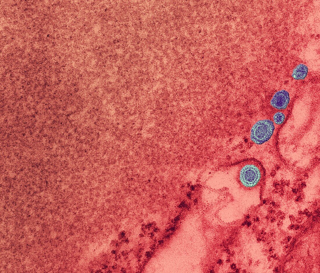 Rabies virus particles,TEM