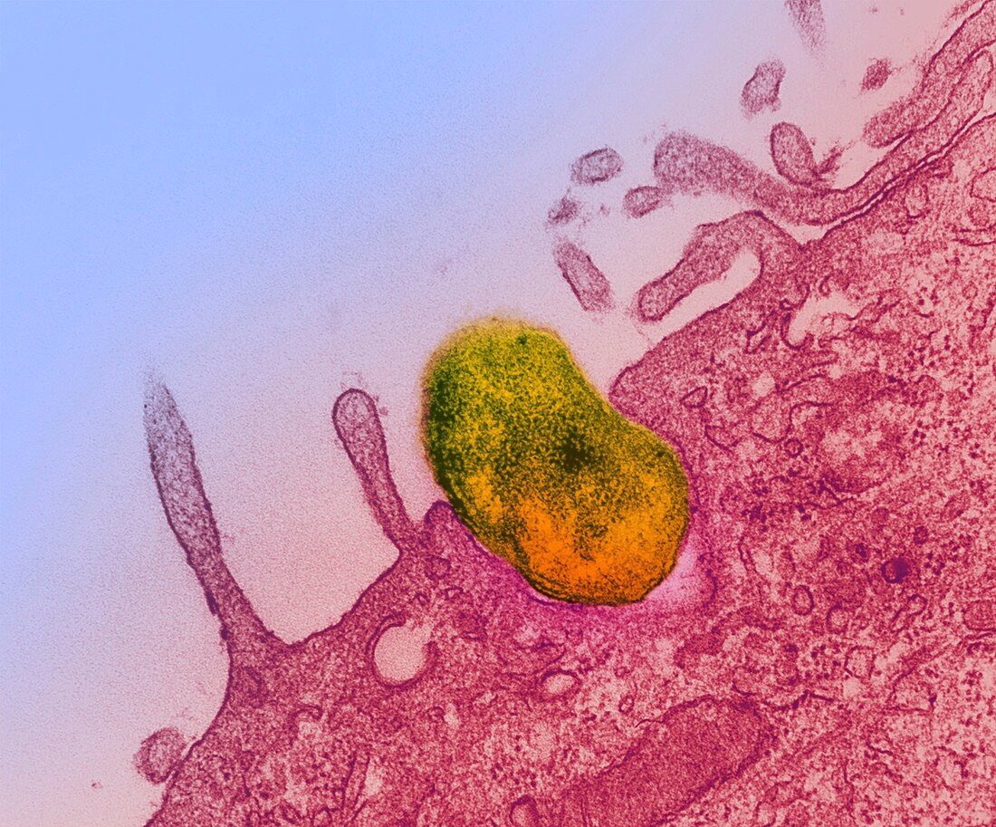 Orientia tsutsugamushi infection,TEM