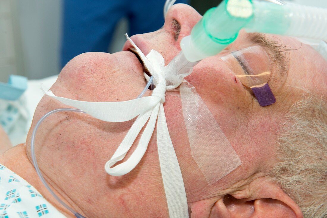 Intubated patient during surgery