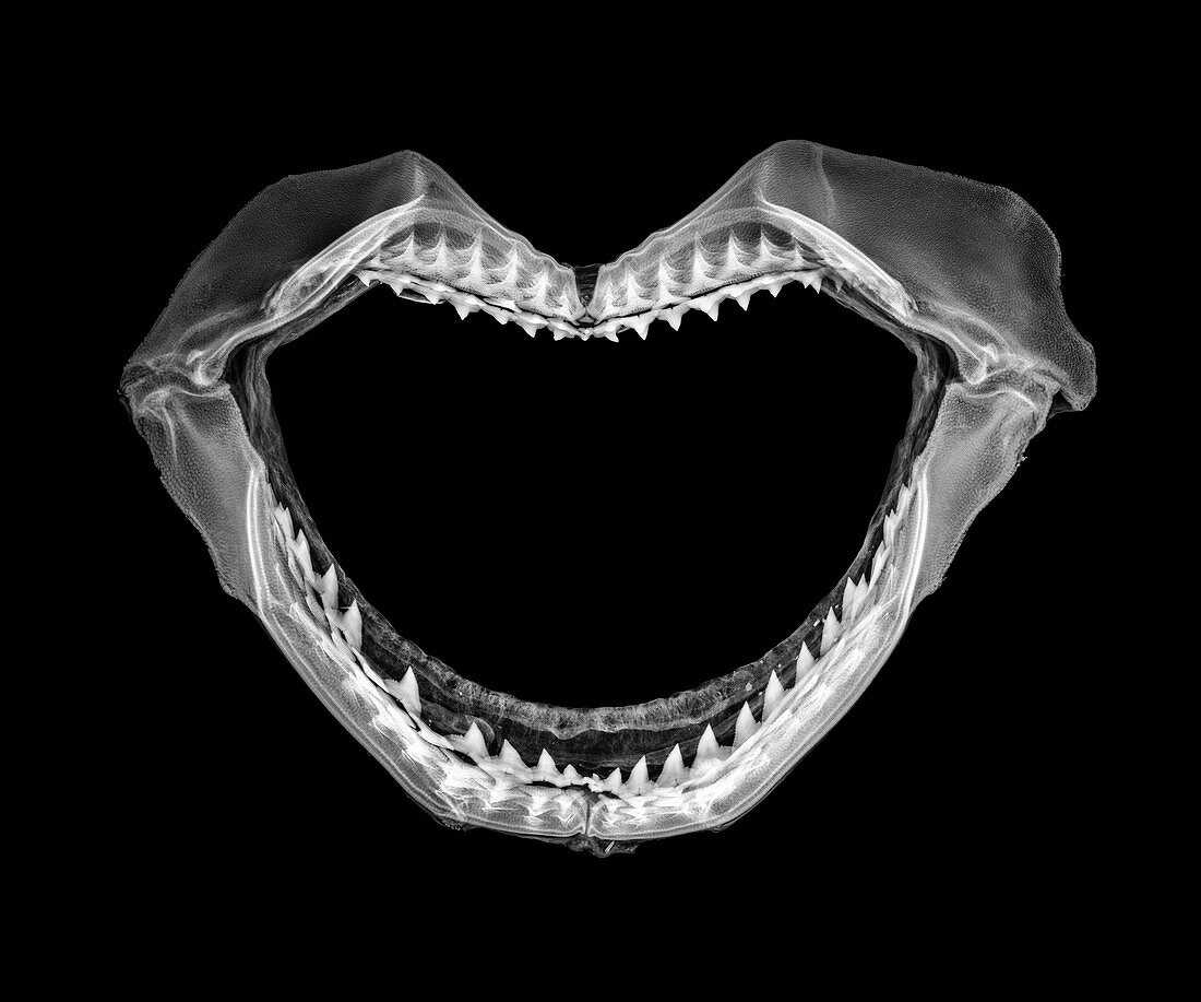 Shark jaws,X-ray