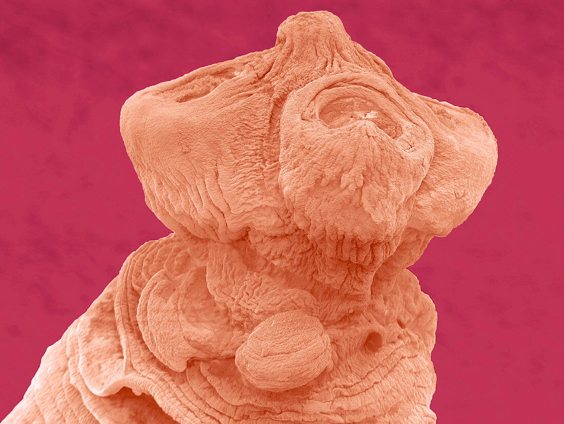 Anoplocephala tapeworm,ESEM