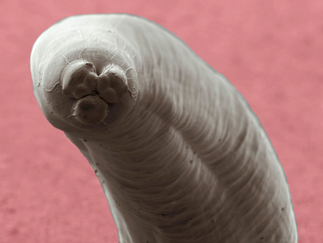 Ascaris roundworm,ESEM