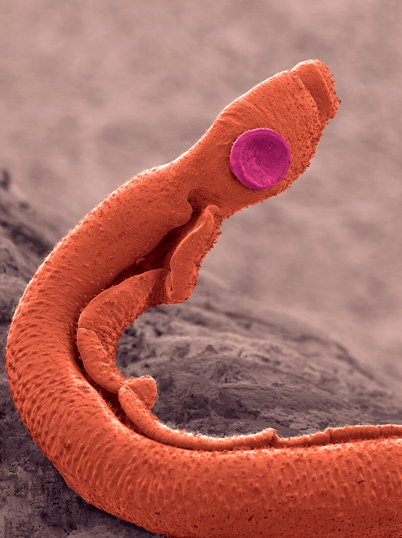 Schistosoma flatworm,ESEM