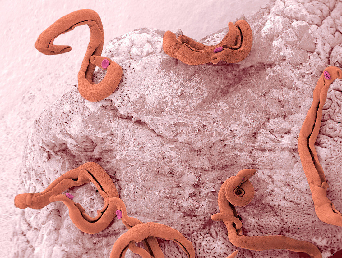 Schistosoma flatworms,ESEM