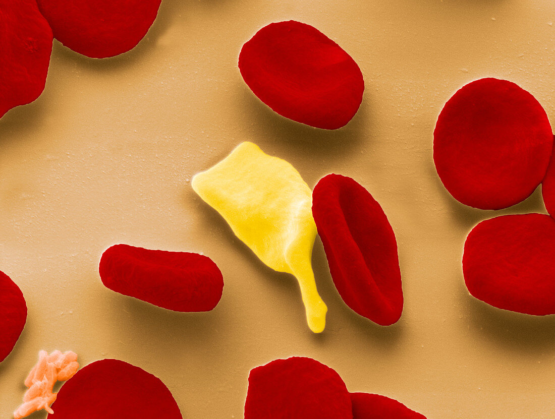 Blood cells in malaria infection,ESEM