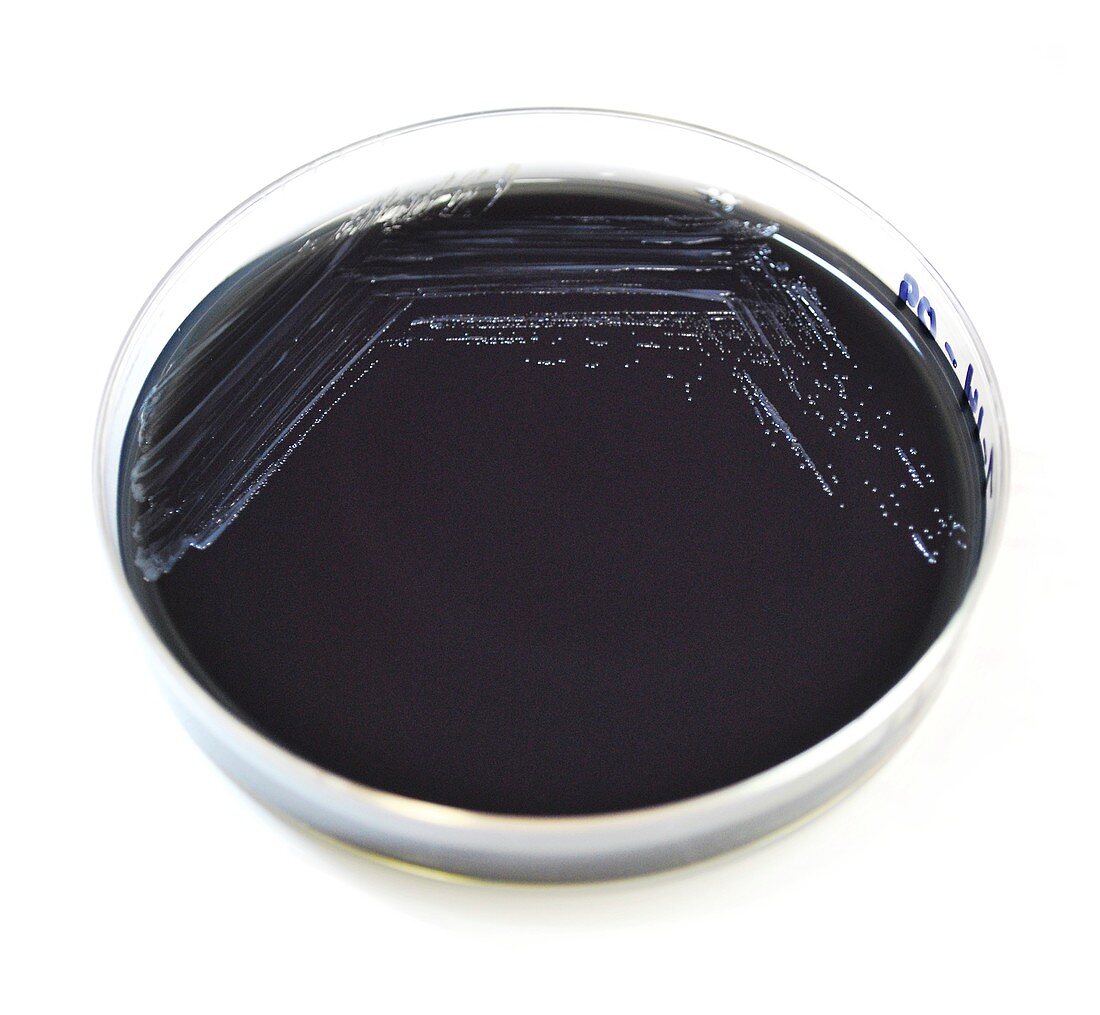 Tularemia bacteria culture