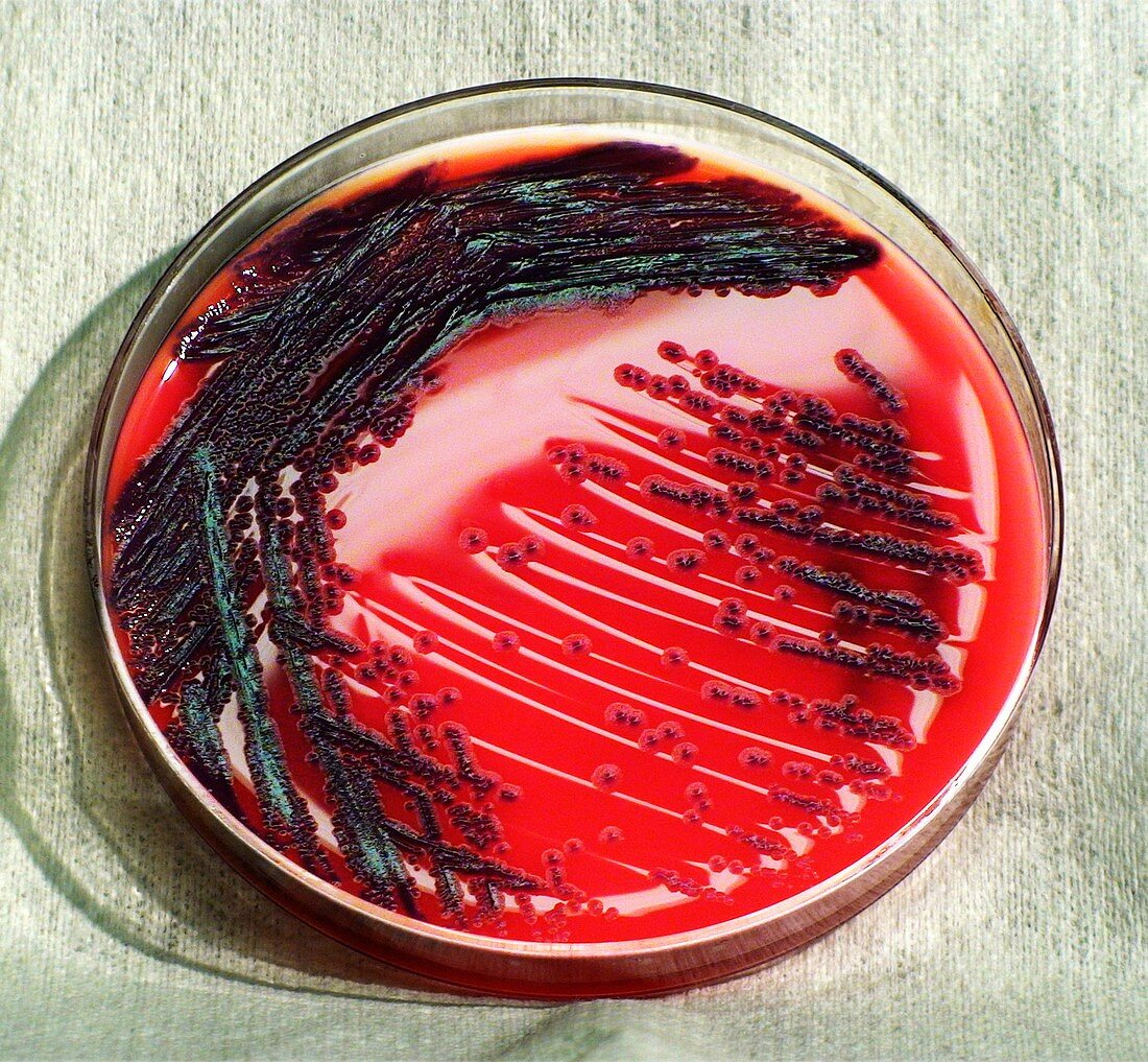 C. violaceum bacteria culture