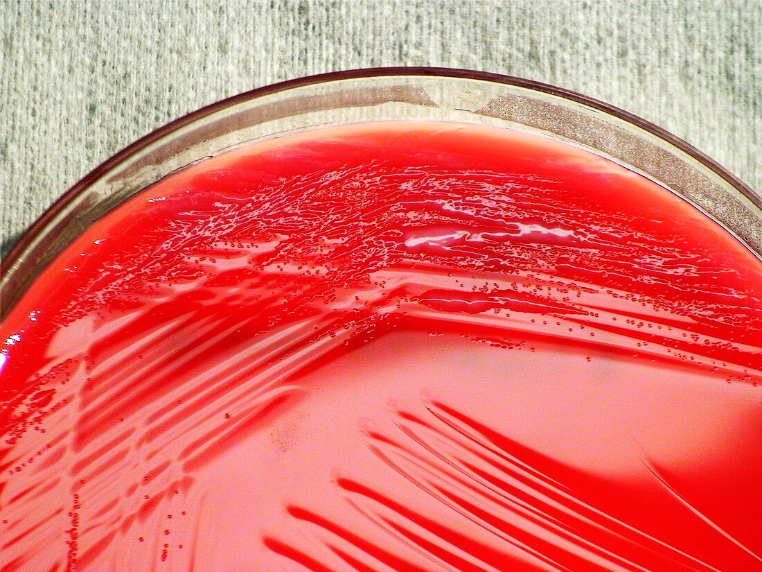 Pseudomonas fluorescens bacteria culture
