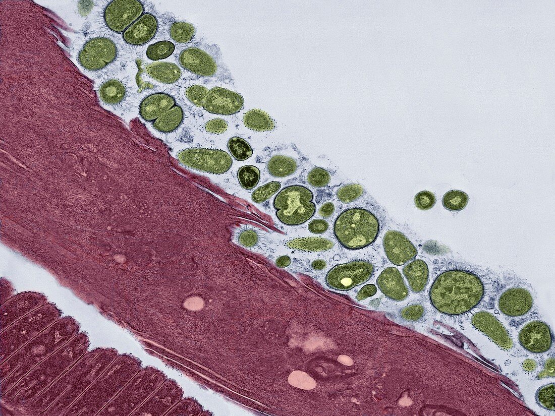 Bacteria on tongue surface,TEM