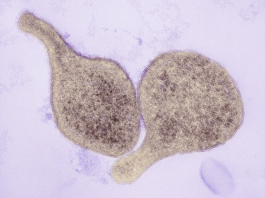 Mycoplasma genitalium bacteria,SEM