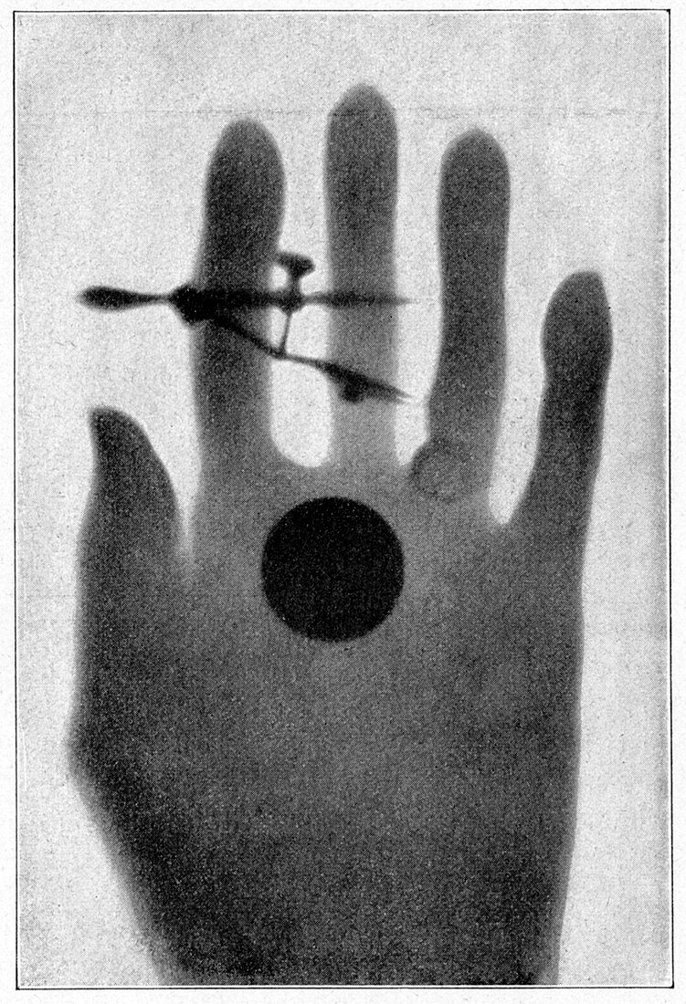 Female hand,19th Century radium ray