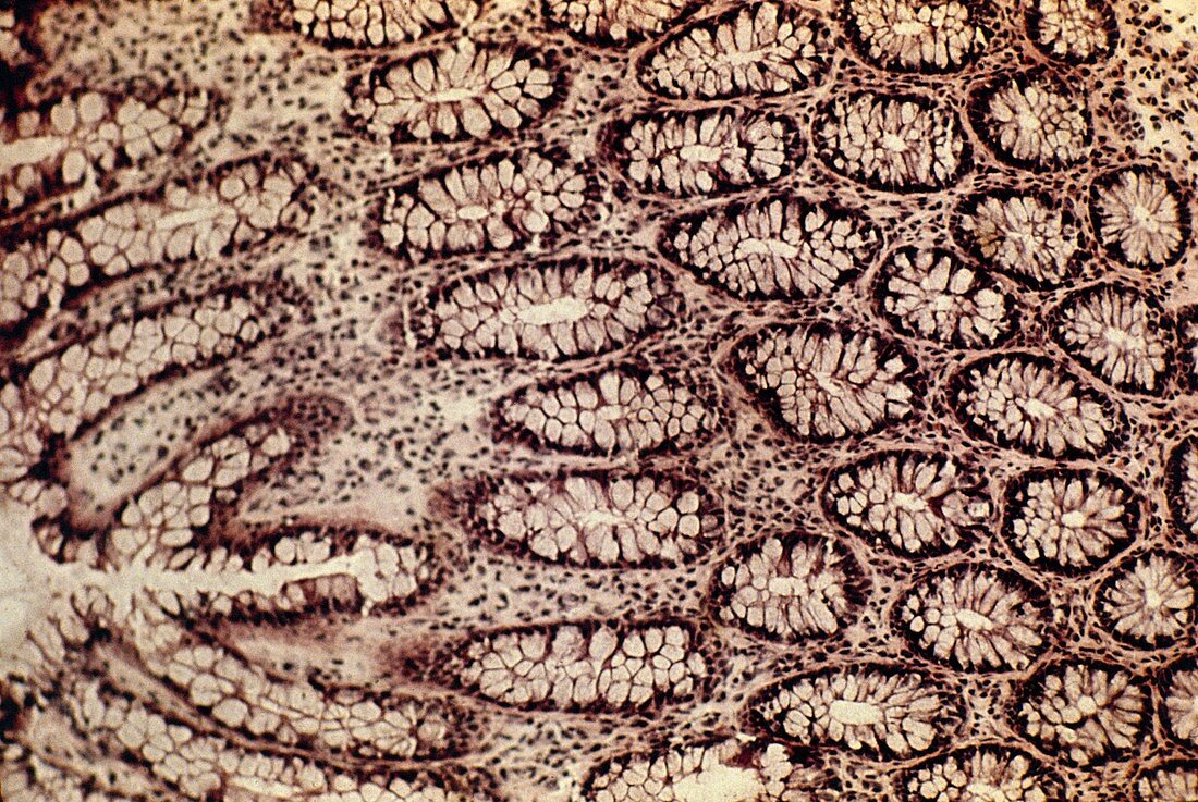 Colon lining,light micrograph