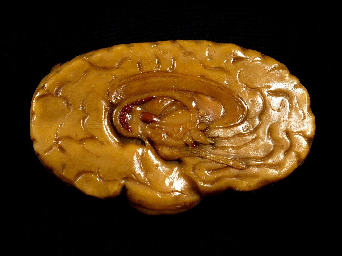 Brain model,18th century