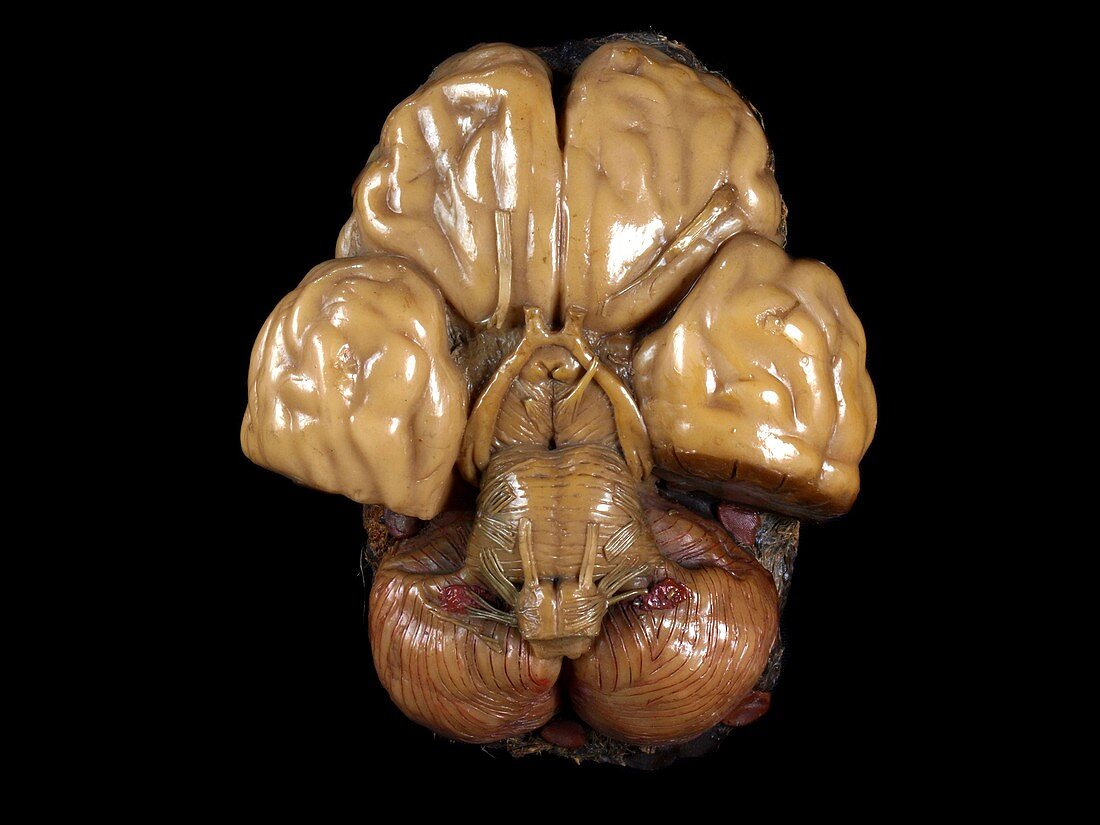 Brain model,18th century