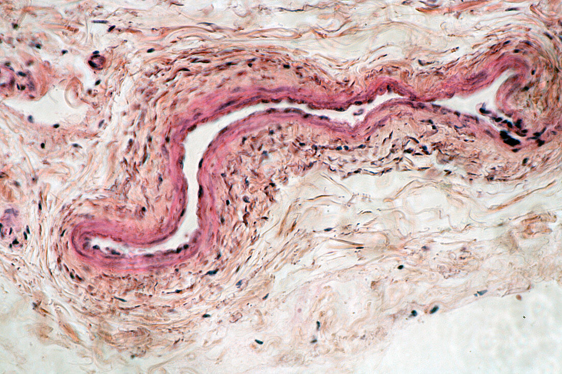 Vein cross-section. LM