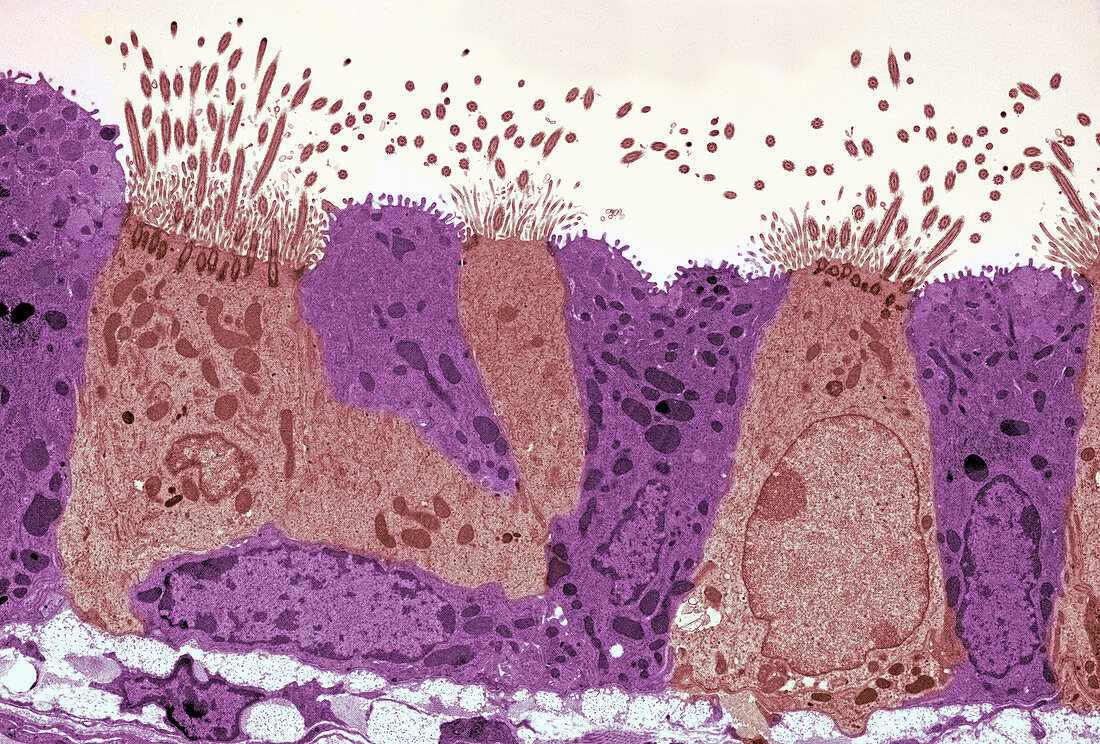 Lung epithelial layer