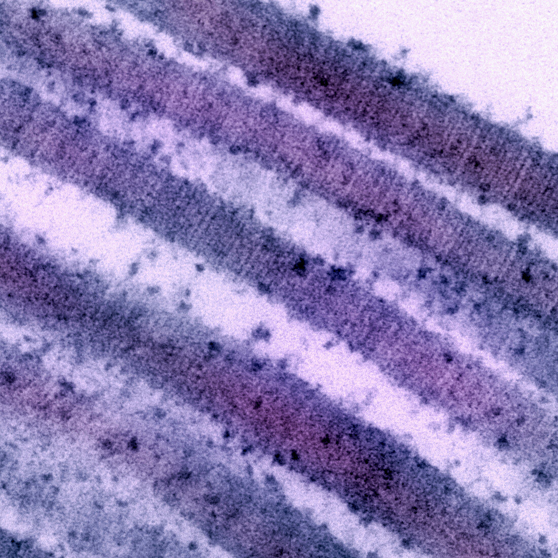 Mouse lung collagen. TEM