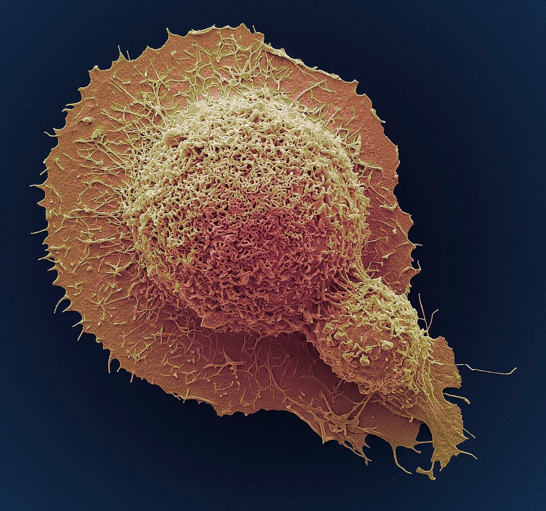 Colorectal cancer cell,SEM