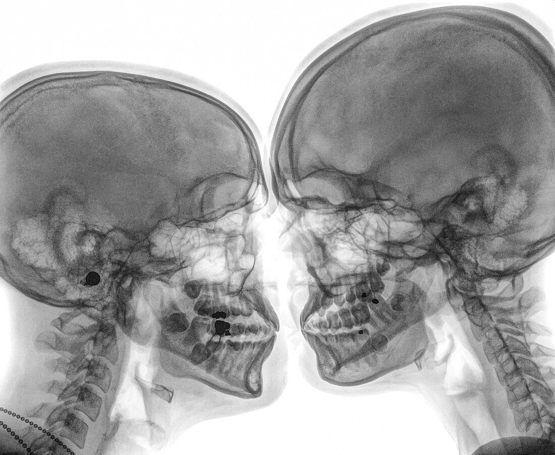 Kissing Couple