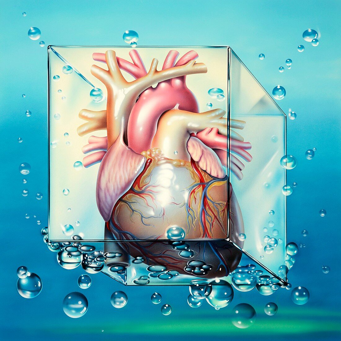 Cardiogenic shock,artwork