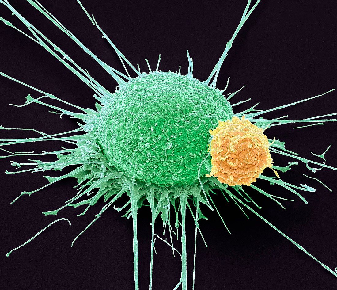 T lymphocyte and cancer cell,SEM