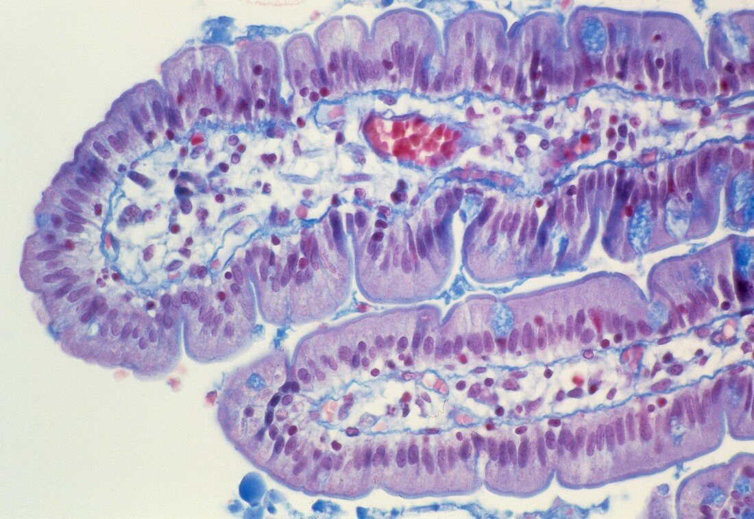 Small intestine lining,light micrograph