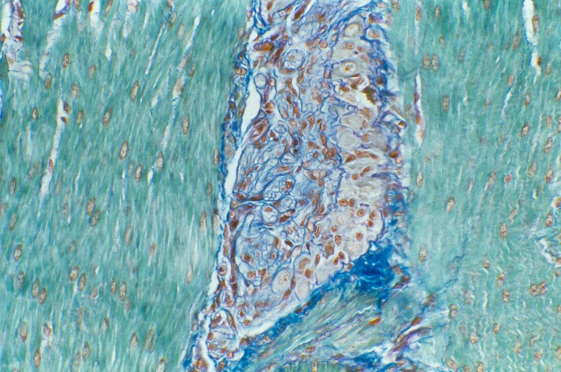 Intestinal nerves,light micrograph