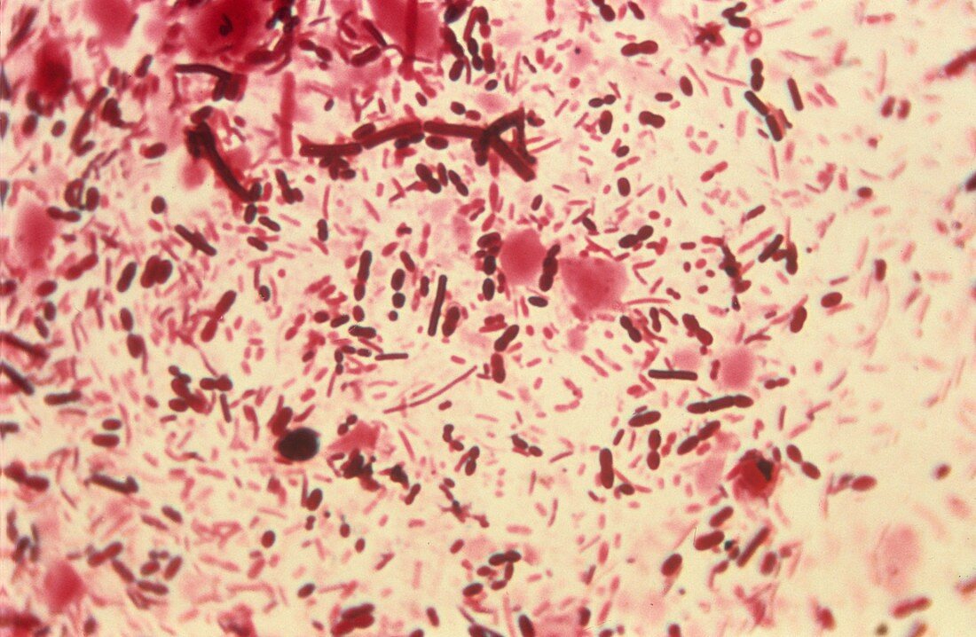 Intestinal bacteria,light micrograph
