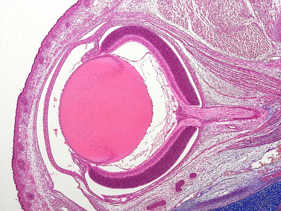 Foetal eye,light micrograph