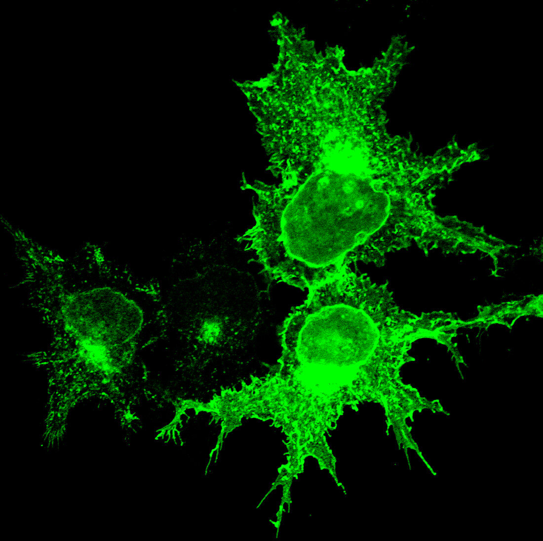 KIAA0319 protein,immunofluorescent image
