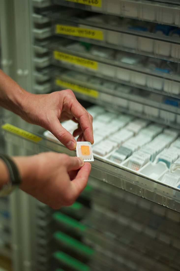 Cancer research,biobank sample
