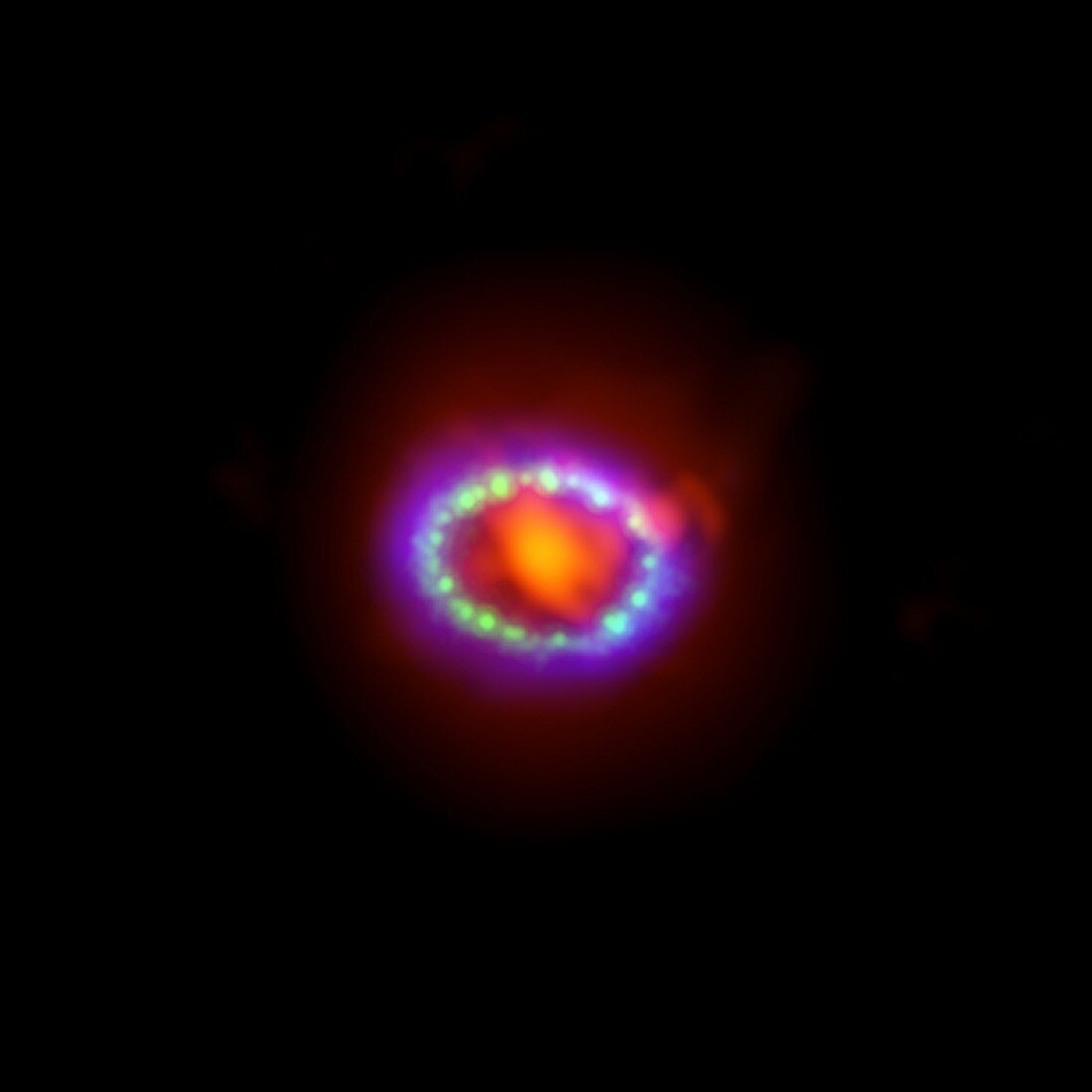 Supernova 1987A remnant,composite